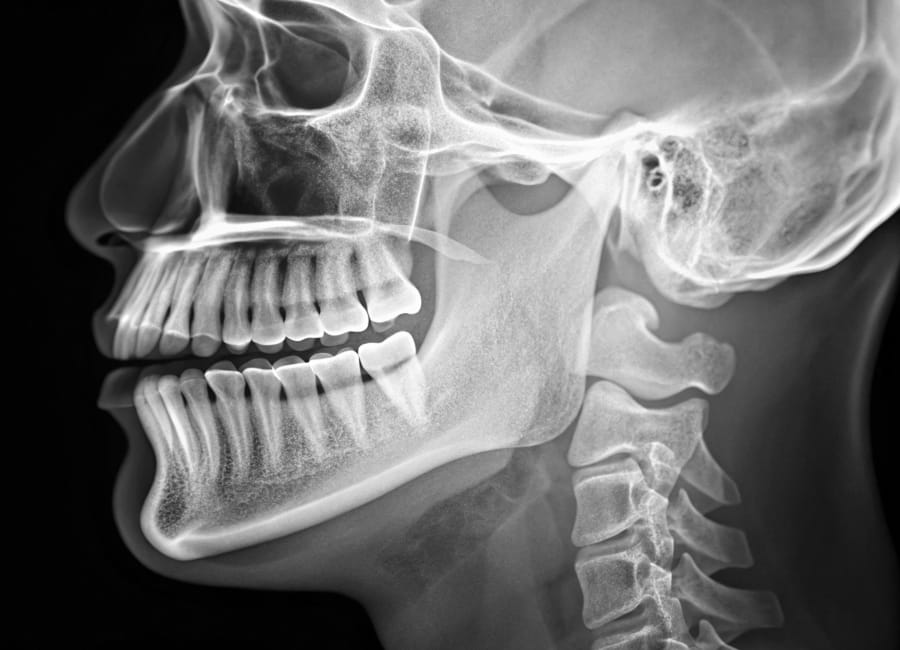 A dental professional showing cephalometric radiograph