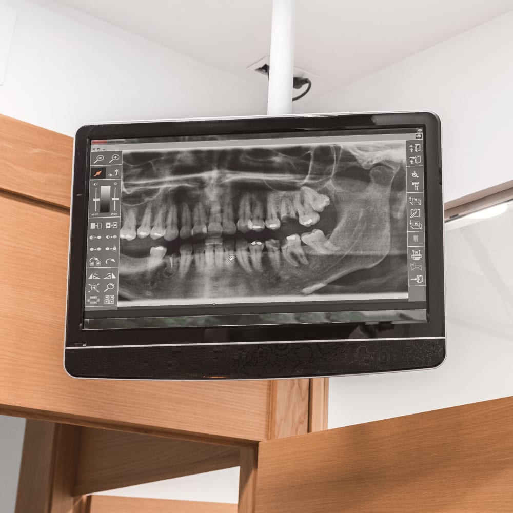 A computer monitor hangs from the ceiling showing an image of a panoramic X-ray.